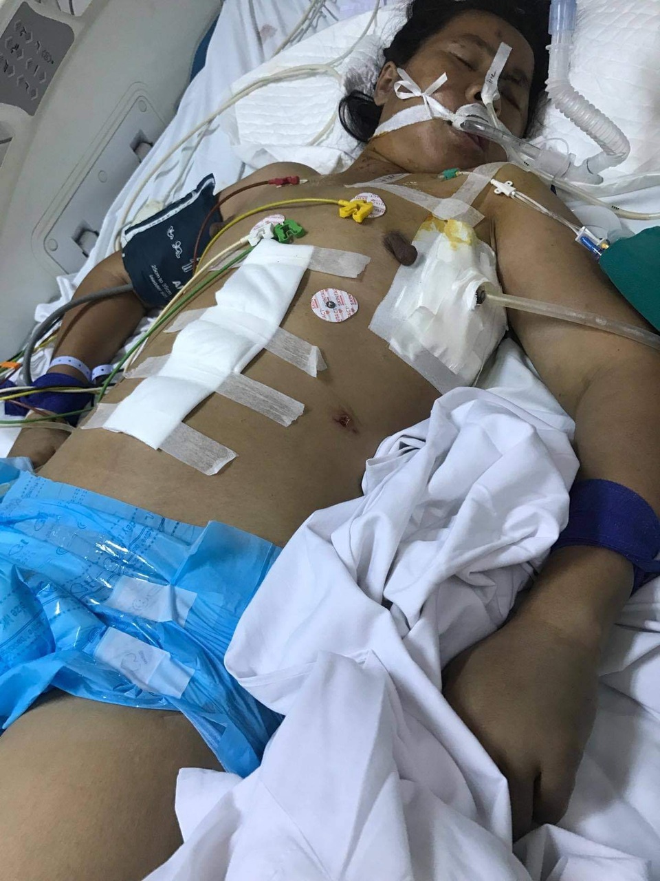 Xót xa cảnh 5 đứa trẻ sống lay lắt sau khi cha mẹ bị tai nạn nguy kịch - 1 Xót xa cảnh 5 đứa trẻ sống lay lắt sau khi cha mẹ bị tai nạn nguy kịch - 1