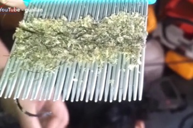 Choáng với cô bé “nuôi” hàng triệu con chấy trên đầu