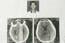 Vụ nam sinh bị đánh chấn thương não: Công an lý giải nguyên nhân chậm trễ