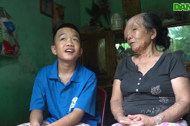 Sóng gió cuộc đời của người đàn bà mang khuôn "mặt quỷ"