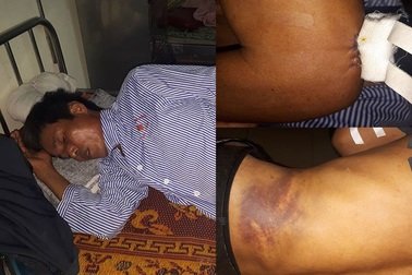 Ngăn trâu bò thả rông, trưởng thôn bị đánh nhập viện