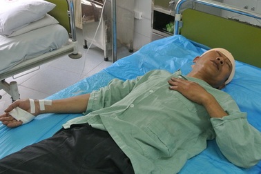 Hà Nội: Dùng búa rìu chém vỡ đầu đồng nghiệp