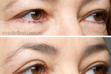 Những cách gìn giữ “cửa sổ tâm hồn” 