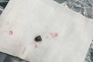 Bắt nghi phạm dùng súng tự chế bắn tài xế ở Đồng Nai