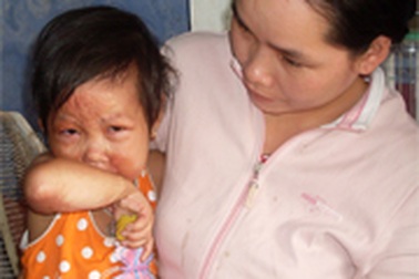 Quỹ nhân ái đến với hai cảnh đời bất hạnh tại huyện Hương Thủy