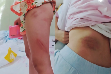 Công an thụ lý đơn khiếu nại của ông bà nội 2 cháu bé nghi bị bạo hành