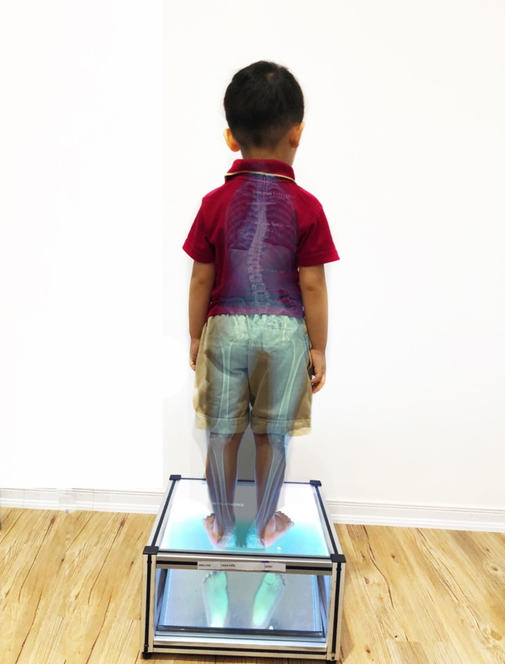 Nguy hiểm khi trị hết đau bộ phận này nhưng gây hại đến bộ phận khác - 3