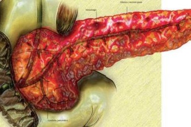 Đau bụng dữ dội, không ăn được vì nhậu Tết quá đà