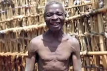 Mắc chứng sợ phụ nữ, người đàn ông trốn biệt trong nhà suốt hơn 55 năm