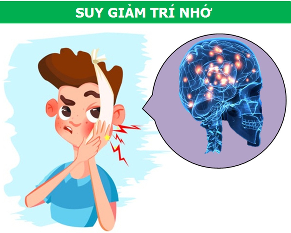 Những cơn đau kỳ lạ xuất phát từ răng miệng nói lên điều gì về sức khỏe? - 5 Những cơn đau kỳ lạ xuất phát từ răng miệng nói lên điều gì về sức khỏe? - 5