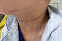 Bé 5 tuổi nghịch dây quần áo, bị dây thắt vào cổ