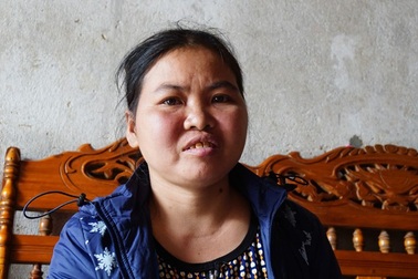 Khốn khổ người phụ nữ mắc bệnh lupus ban đỏ “gánh” cả nhà “ra ngẩn vào ngơ”