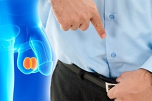 Bệnh hiếm gặp - Ung thư dương vật