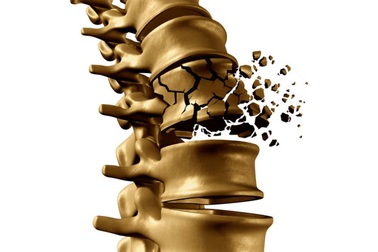 Những sai lầm thường gặp khi bổ sung canxi