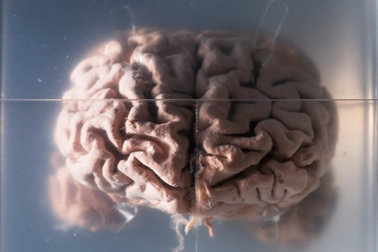 Thực hư việc biến đổi khí hậu làm teo não người