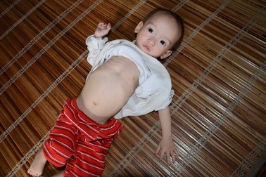 Gia cảnh khốn cùng của bé 14 tháng tuổi chỉ nặng có 4,5kg