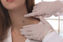 U lành tính là gì?