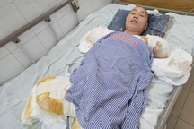 Cuộc sống nghiệt ngã của người phụ nữ bị bỏng điện cao thế