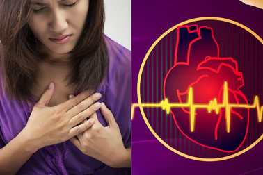 Nhịp nhanh xoang có chữa được không? cách nào giúp giảm nhẹ bệnh