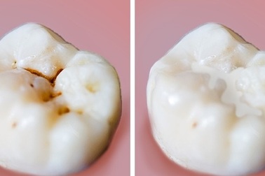 8 sai lầm phổ biến khi chăm sóc răng