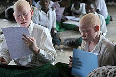 Người bạch tạng đầu tiên đắc cử nghị sĩ Tanzania