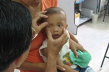 Ung thư trẻ em: Những dấu hiệu nguy hiểm