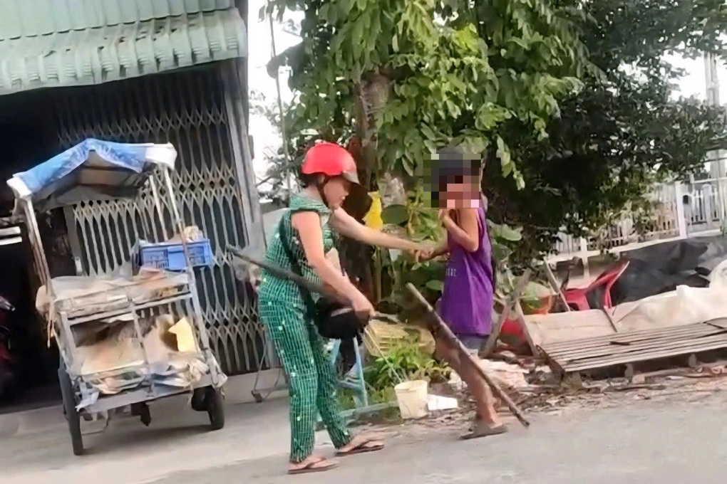 Diễn biến mới vụ bé trai 13 tuổi bị cô ruột đánh đập liên tiếp - 2