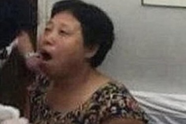 Người phụ nữ cười sái quai hàm theo đúng nghĩa đen