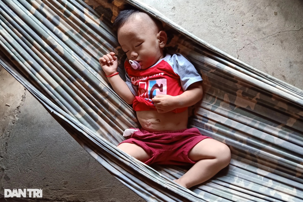 Cám cảnh 3 trẻ thất học, bệnh tật, sống trong căn nhà lá nhỏ như hộp diêm - 3 Cám cảnh 3 trẻ thất học, bệnh tật, sống trong căn nhà lá nhỏ như hộp diêm - 3