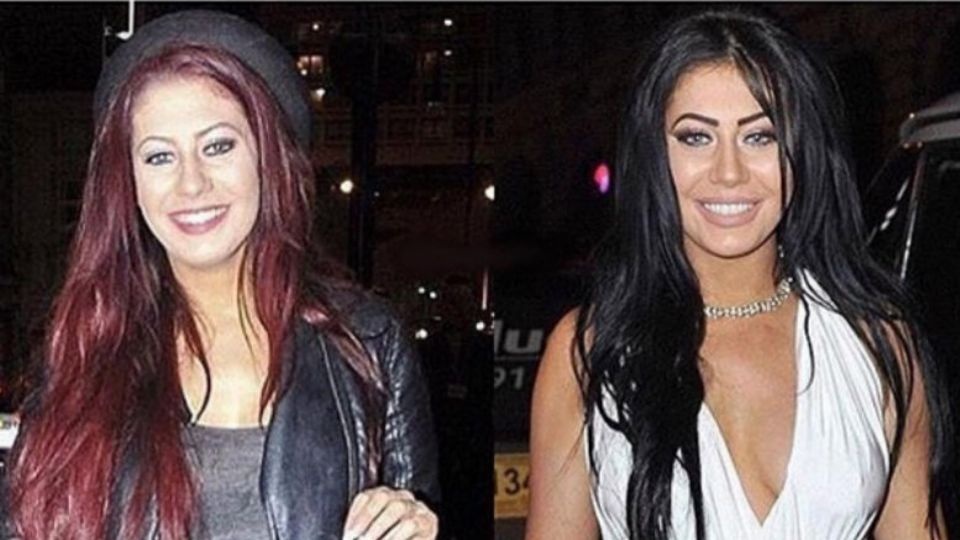 Chloe Ferry tuyên bố dừng phẫu thuật thẩm mỹ - 3 Chloe Ferry tuyên bố dừng phẫu thuật thẩm mỹ - 3