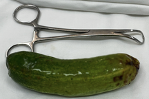 Nam thanh niên nhét quả dưa leo 10cm vào hậu môn để "thử cảm giác lạ"