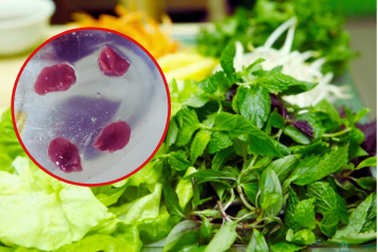 Cô gái có 7 loại giun sán ký sinh trong người vì mê loại rau này