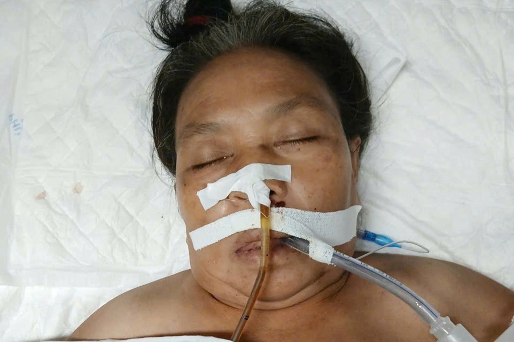 Người phụ nữ bị bò húc, chồng hờ xin đưa về vì không tiền chữa trị - 1 Người phụ nữ bị bò húc, chồng hờ xin đưa về vì không tiền chữa trị - 1