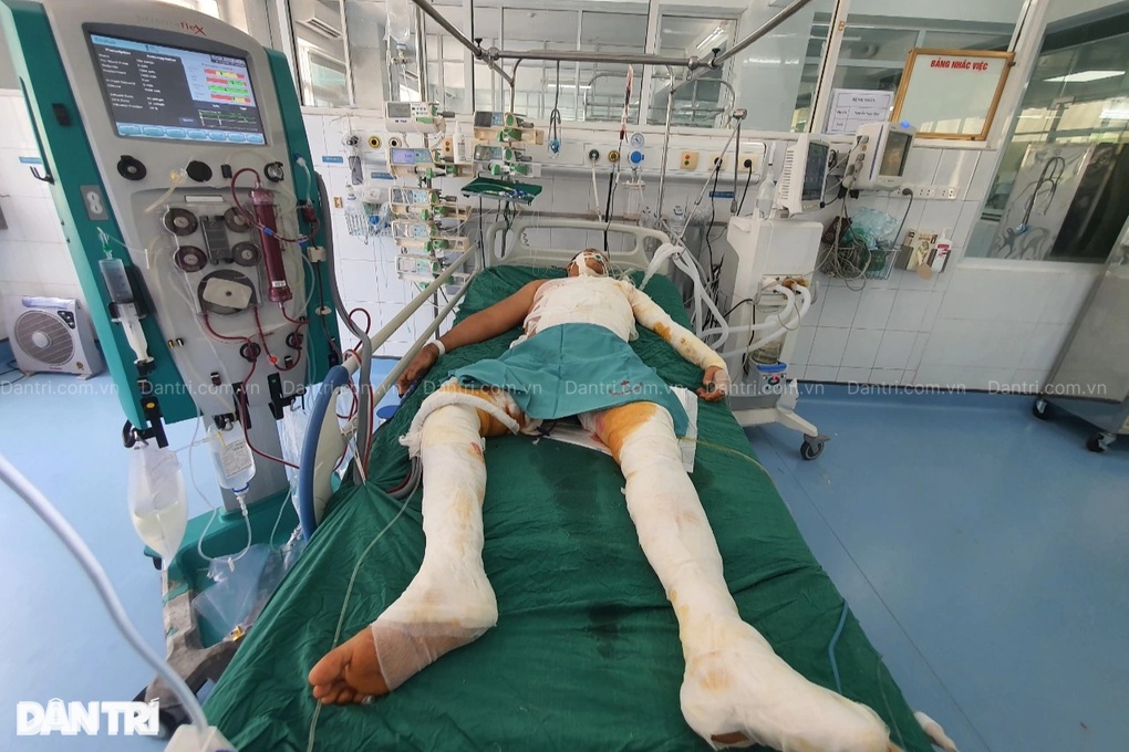 Mẹ già bán ruộng đã cùng kiệt, xin cứu con bị bỏng điện cao thế 50% cơ thể - 3 Mẹ già bán ruộng đã cùng kiệt, xin cứu con bị bỏng điện cao thế 50% cơ thể - 3