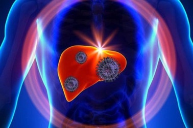 Viêm gan B có tiến triển thành xơ gan không?