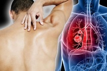 Ung thư phổi của bạn đã lan tới đâu trong cơ thể?