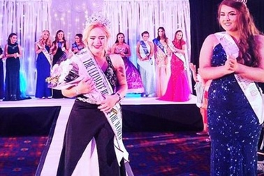 Cô gái mắc hội chứng Down đầu tiên giành giải nhan sắc quốc tế