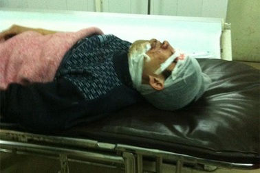 Hà Nội: Chủ sạp thịt lợn bị “đồng nghiệp” chém trọng thương