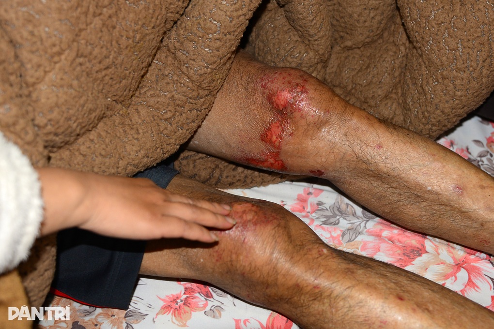 Hành trình sinh tồn 6 ngày trong rừng của cụ ông 78 tuổi ở Lâm Đồng - 2