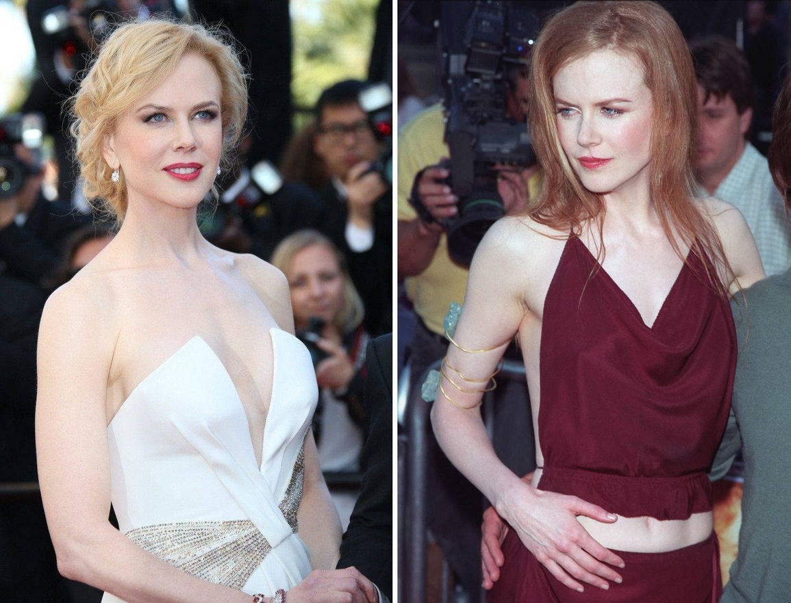 Thiên nga Úc Nicole Kidman trở thành diễn viên vì... da quá trắng - 1