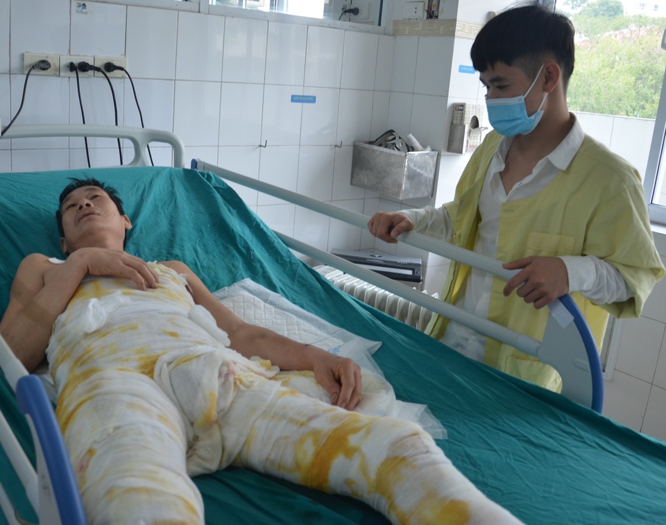 Hoàn cảnh éo le của người đàn ông dậy nấu mì tôm không may ngã vào bếp lửa - 3 Hoàn cảnh éo le của người đàn ông dậy nấu mì tôm không may ngã vào bếp lửa - 3