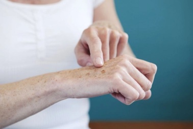 5 dấu hiệu trên mu bàn tay cảnh báo bệnh trong người