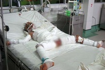 Bé gái bỏng nặng và căn nhà sắp sập...