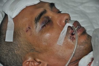 Người đàn ông nguy kịch sau tai nạn ngã lộn qua thành cầu xuống sông