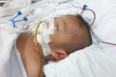 Bé trai 5 tuổi thủng ruột bất thường đã tử vong ở bệnh viện