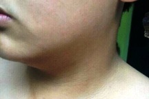 Học sinh lớp 8 bị thầy giáo hành hung đến thương tích?