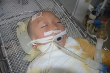 Ngã vào nồi cám lợn, bé 6 tuổi bị bỏng sâu 65% cơ thể