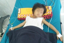 Tự làm thịt cóc ăn, 2 trẻ tử vong, 1 trẻ nguy kịch