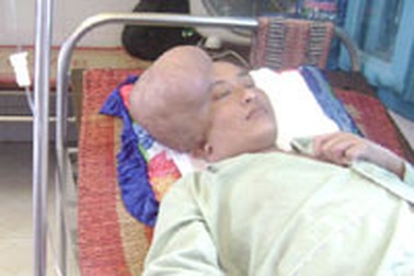 Chàng thanh niên “hai đầu”