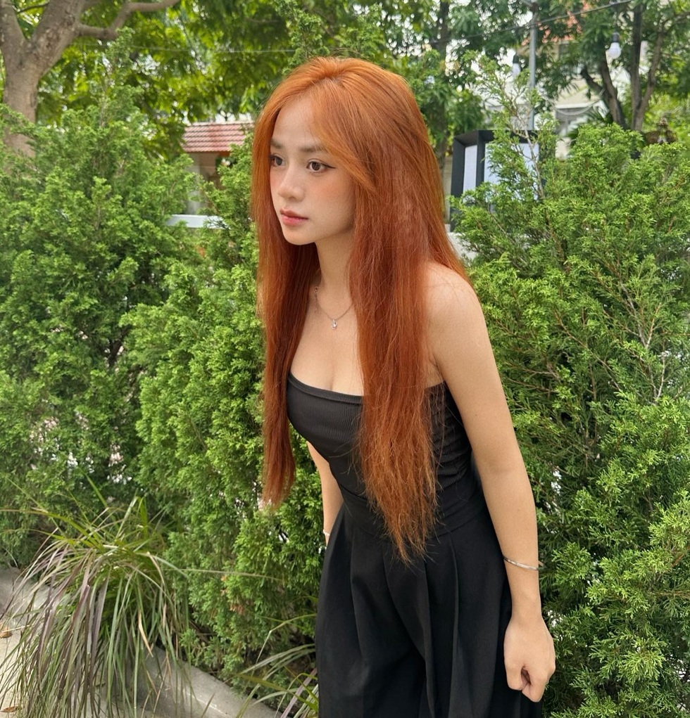 Nữ sinh Bắc Giang có hai màu mắt: Trải qua 5 lần phẫu thuật vẫn yêu đời - 4 Nữ sinh Bắc Giang có hai màu mắt: Trải qua 5 lần phẫu thuật vẫn yêu đời - 4